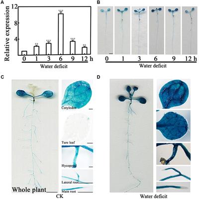Arabidopsis PCaP2 Functions as a Linker Between ABA and SA Signals in Plant Water Deficit Tolerance
